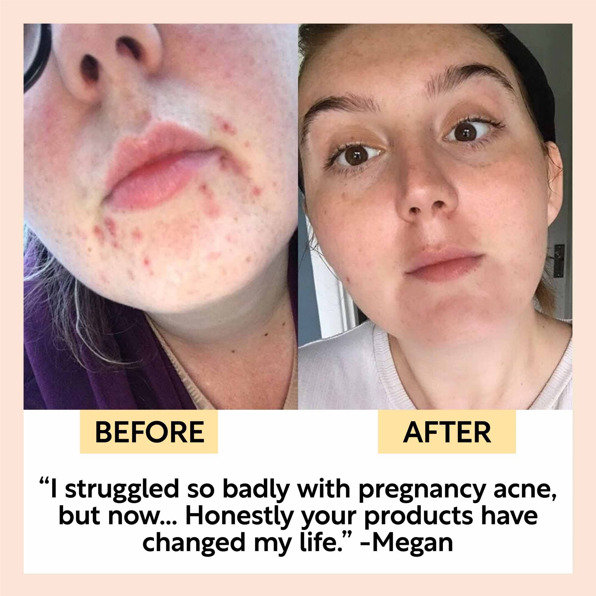 UpCircle USA - Face Moisturizer with Vitamin E + Aloe Vera