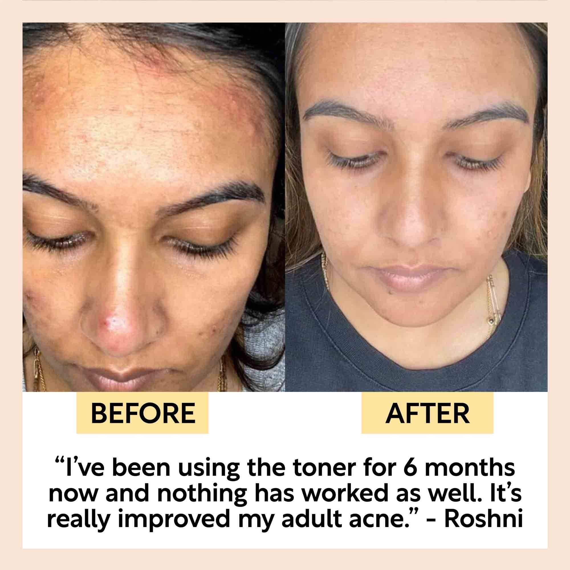 UpCircle USA - Eco Friendly + Sustainable Face Toner with Hyaluronic Acid