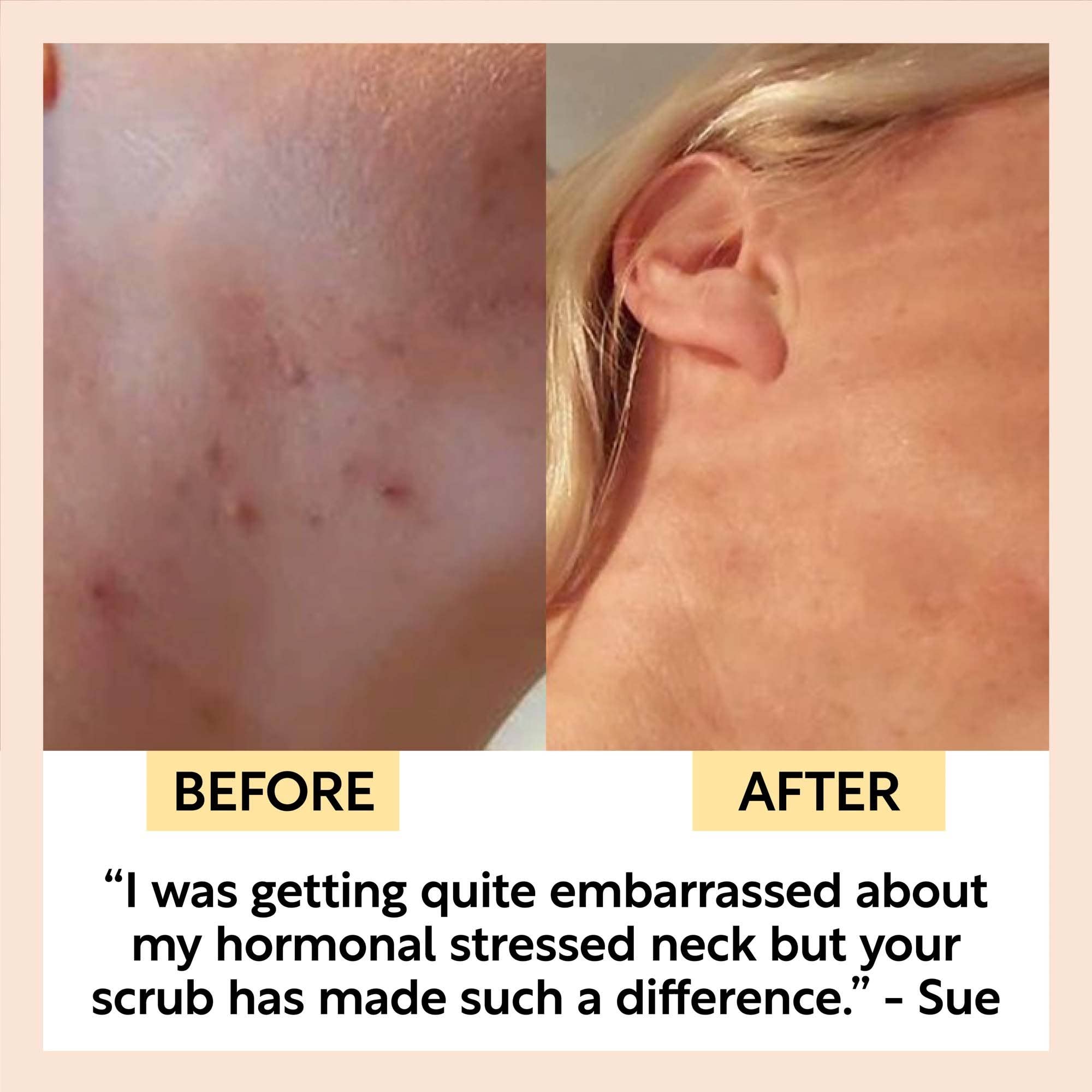 UpCircle USA - Coffee Eco Friendly Face Scrub