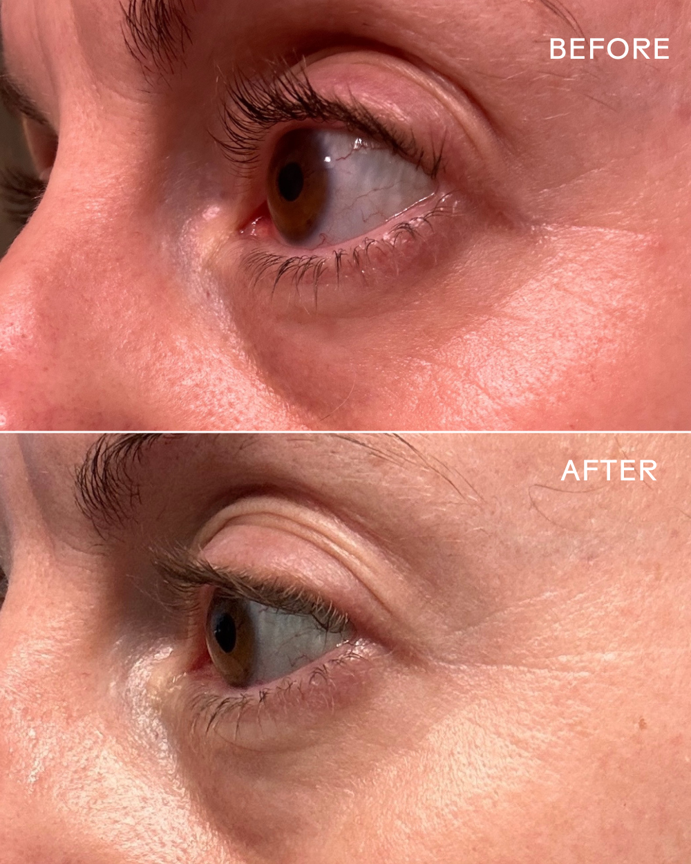 Three Ships - Eye Hero Bio-Retinol Smoothing Eye Cream