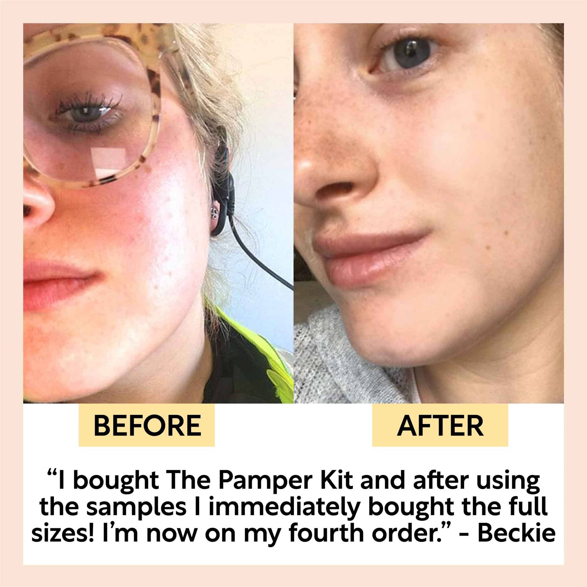 UpCircle USA - Pamper Kit - Eco Vegan Samplers