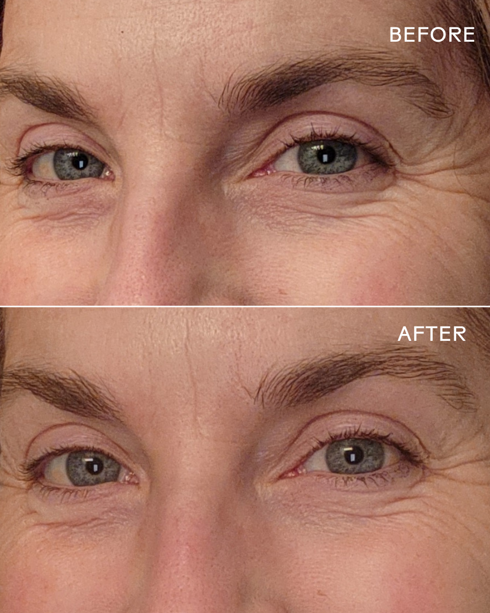 Three Ships - Eye Hero Bio-Retinol Smoothing Eye Cream
